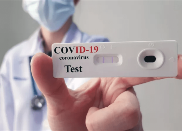 test-sierologici-covid-19-coronavirus-min